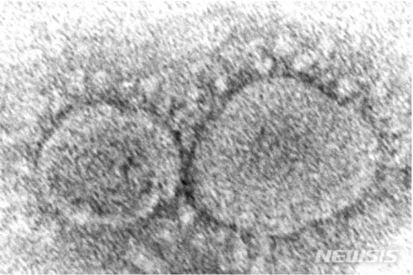 미국 질병통제예방센터(CDC)가 지난해 제공한 코로나19 바이러스 입자의 전자 현미경 이미지.